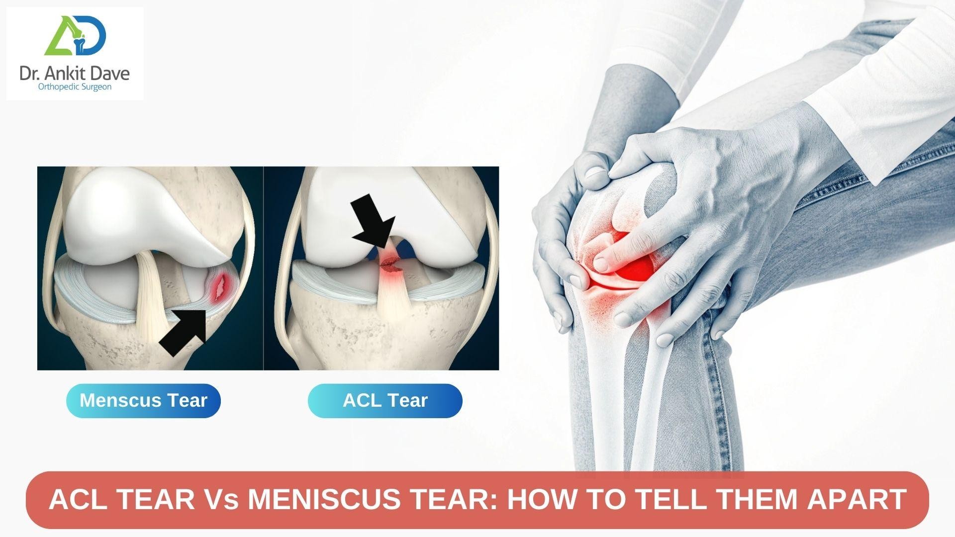 Best Orthopedic Surgeon In Nairobi