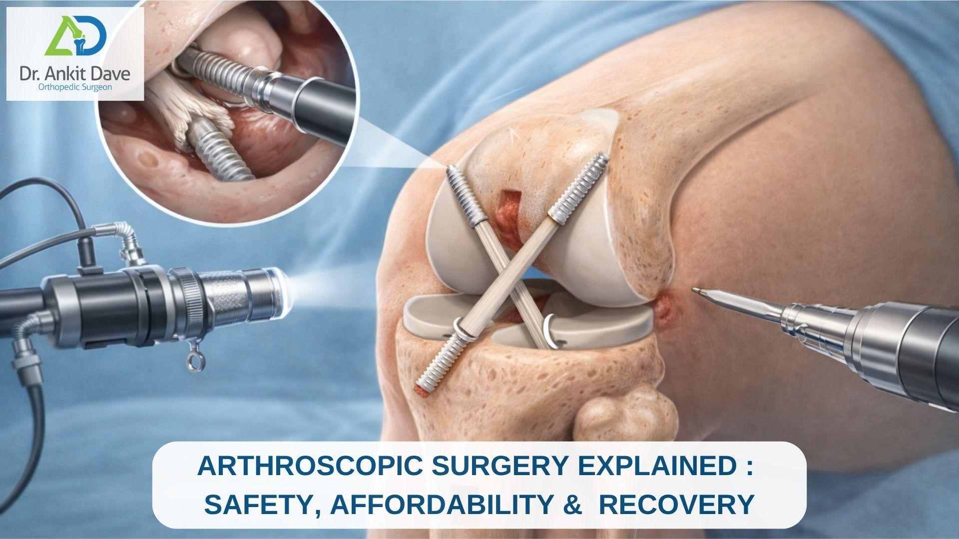 Arthroscopic Surgery in Nairobi